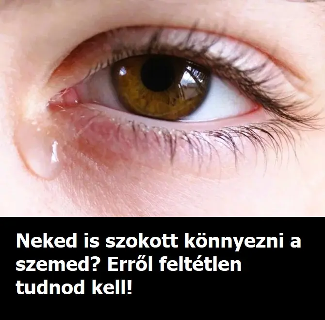 konnyezo szem