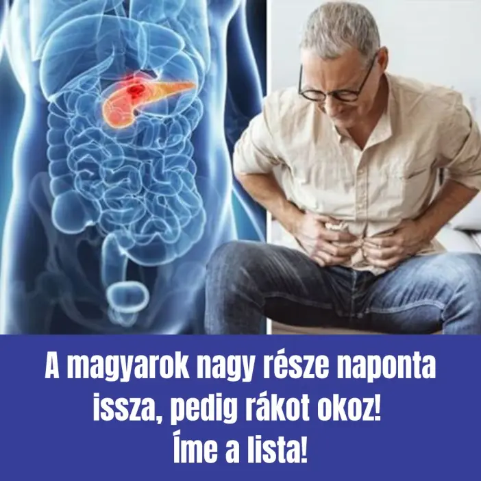 rakot okoz