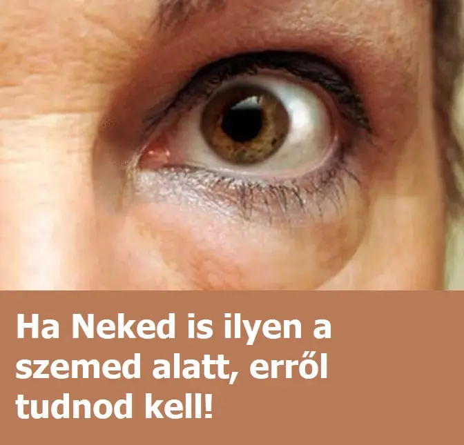 szemkornyek